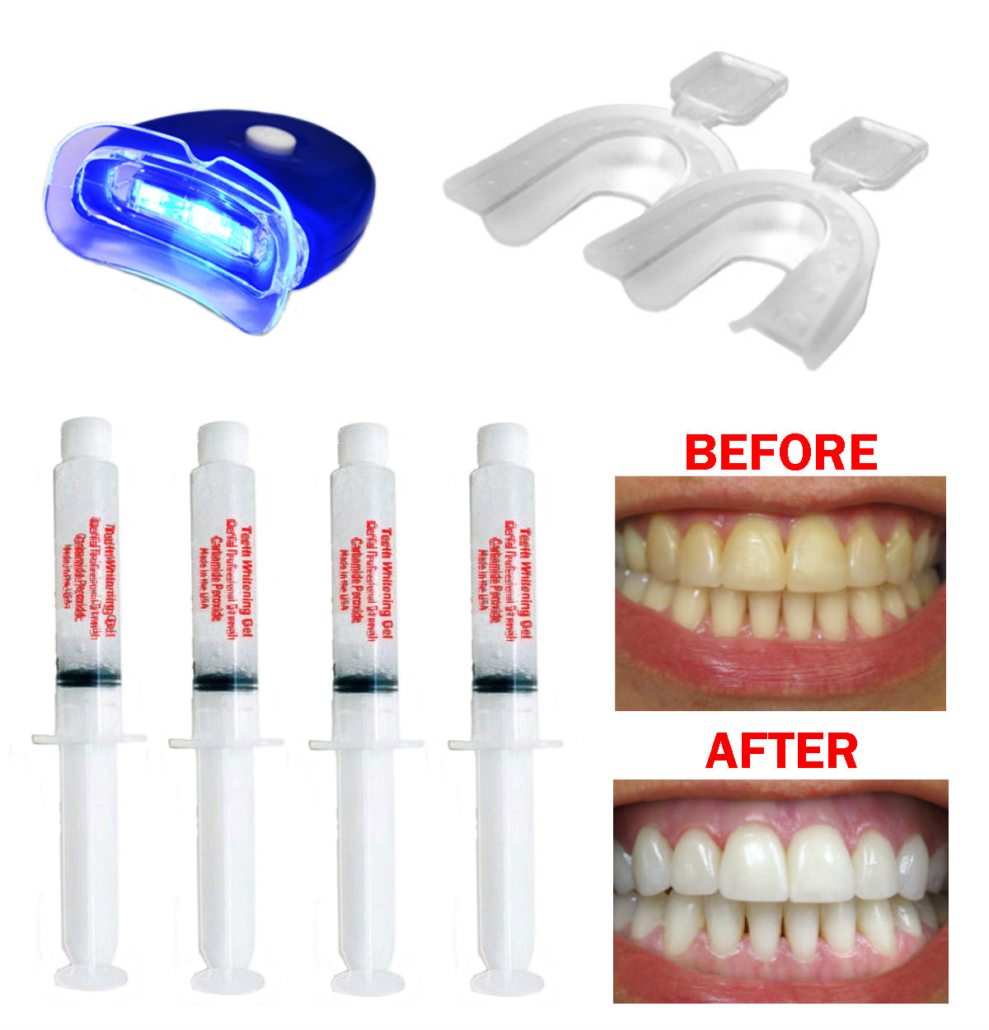 Complete Teeth Whitening Kit Home System 22 Gel Syringe Kit USA